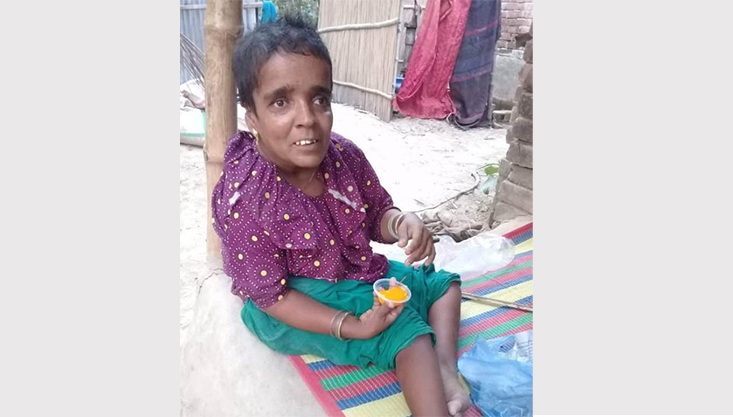 গাংনীতে প্রতিবন্ধী ভাতাতে চলে সংসার, চিকিৎসায় সহযোগিতার আহবান