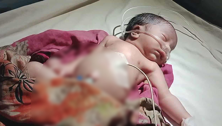 বাঁশ বাগানে ফেলে যাওয়া সেই নবজাতকের চিকিৎসাধীন অবস্থায় মৃত্যু