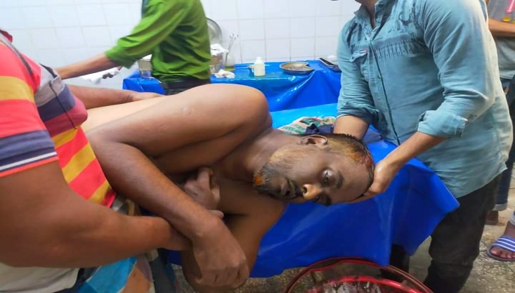 মেহেরপুরে দুই ভাইয়ের মধ্যে সংঘর্ষ, আহত ২